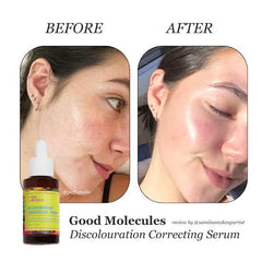 DISCOLORATION CORRECTING SERUM 30 ML