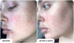 Paula's Choice 10% Azelaic Acid Booster