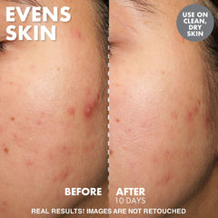 WISHFUL Yo Glow AHA & BHA Facial Enzyme Scrub 40 ml