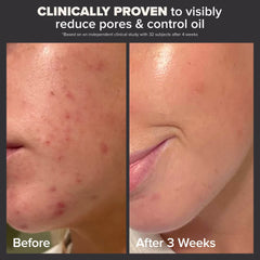 Paula's Choice The Protect and Perfect Pair