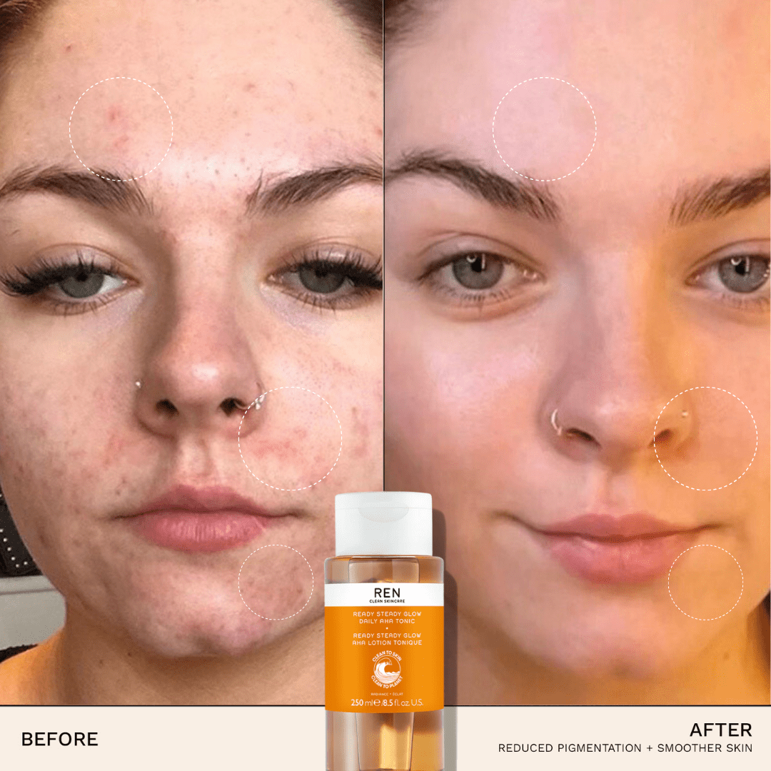 Ren Skin Care Radiance Ready Steady Glow Daily AHA Tonic