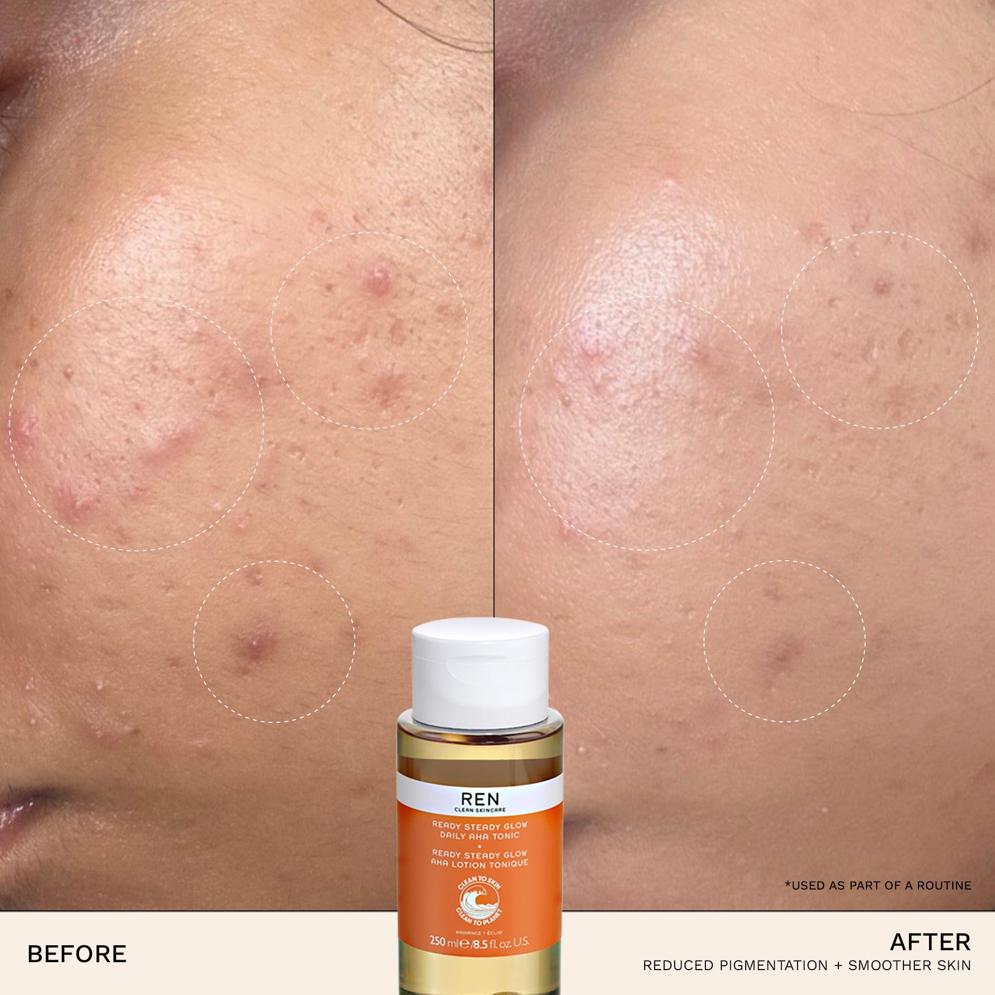 Ren Skin Care Radiance Ready Steady Glow Daily AHA Tonic